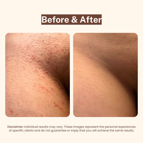 Bikini Line Serum